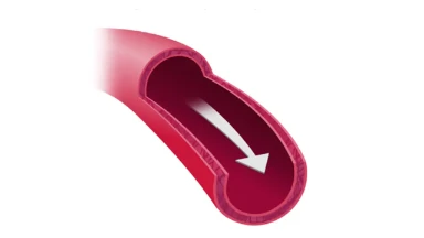 Blood Flow in Artery