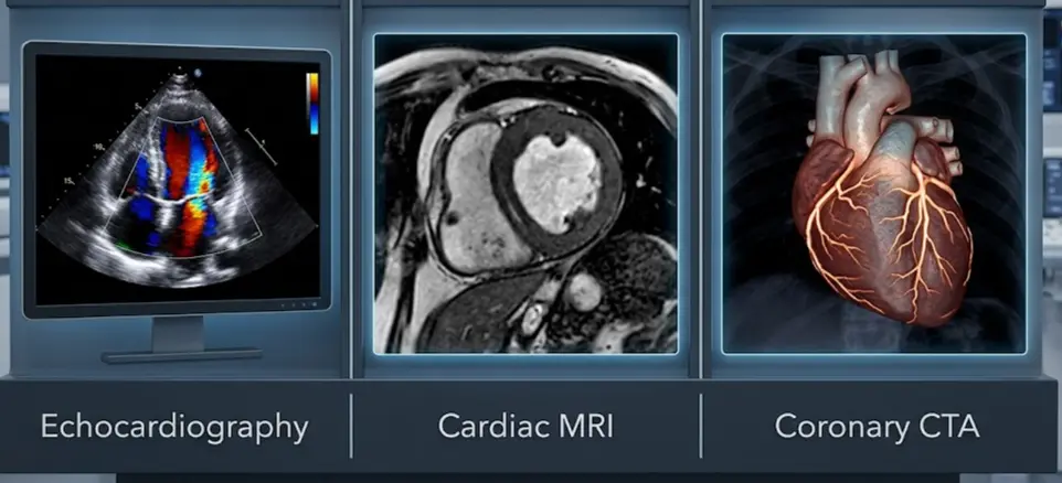 Cardiovascular diagnostic imaging modalities comparison showing Echocardiography with color Doppler flow, high-resolution Cardiac MRI tissue characterization, and 3D Coronary Computed Tomography Angiography (CTA).